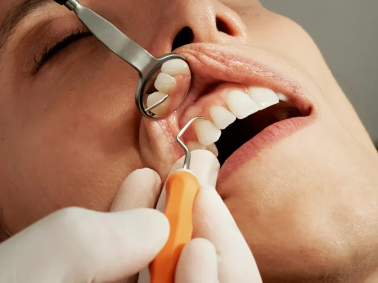 parodontologia sanatatea gingiilor