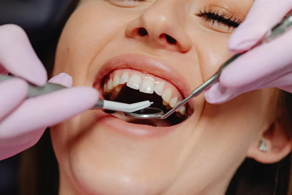 parodontologie sanatatea gingiilor