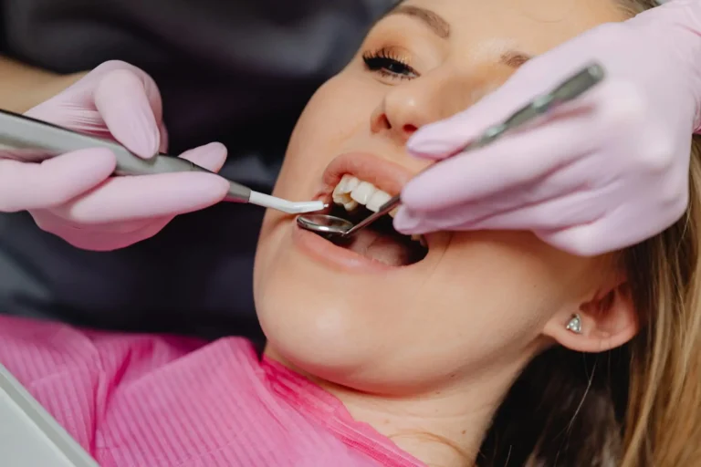 tratamentele cariilor dentare