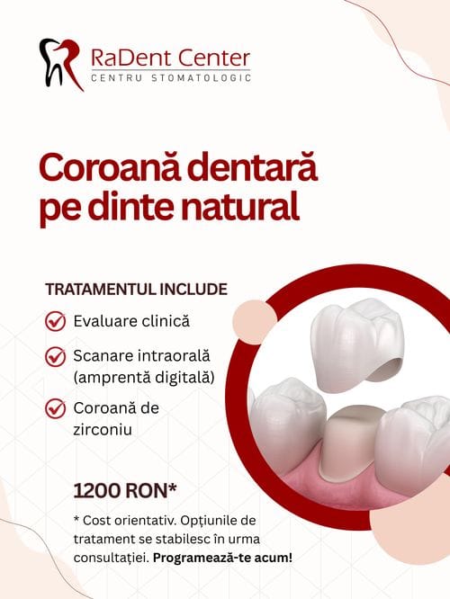 coroana dentara pe dinte natural radent center bucuresti sector 2