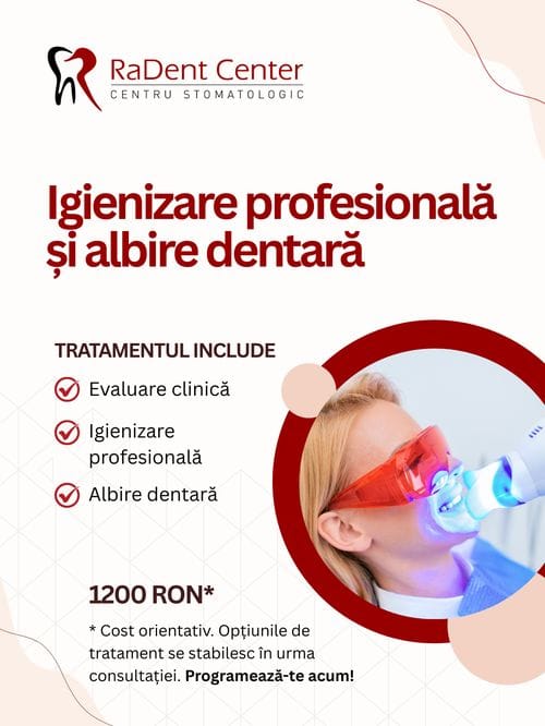 igienizare profesionala albire dentara radent center bucuresti sector 2