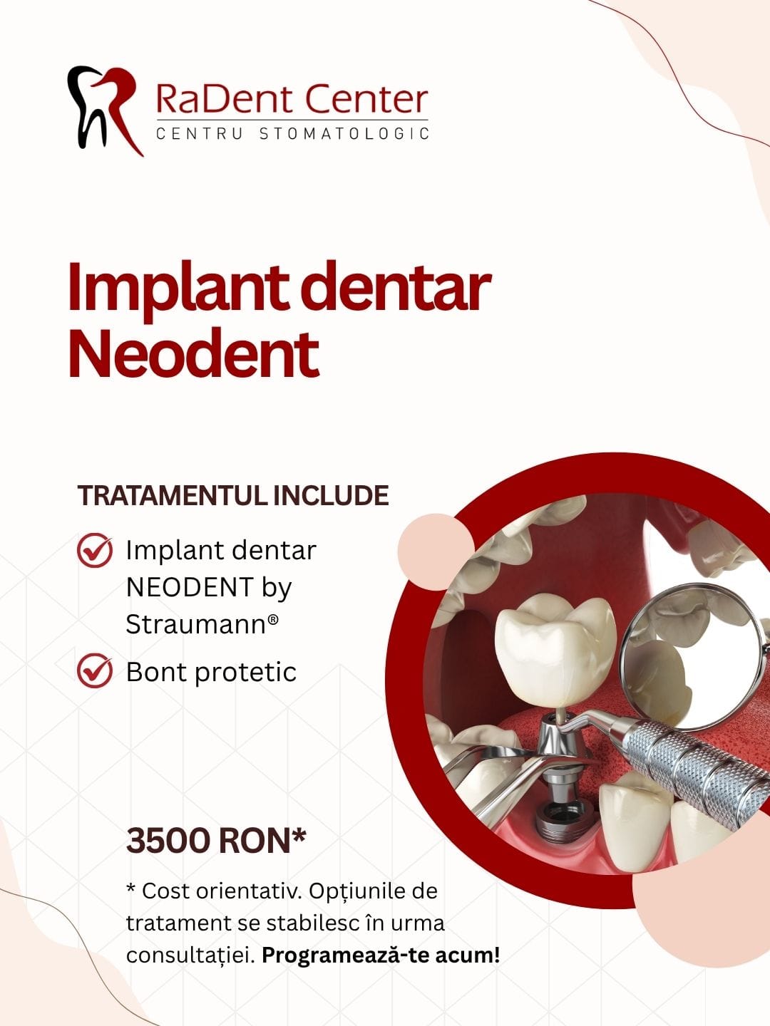 implant dentar complet radent center bucuresti floreasca