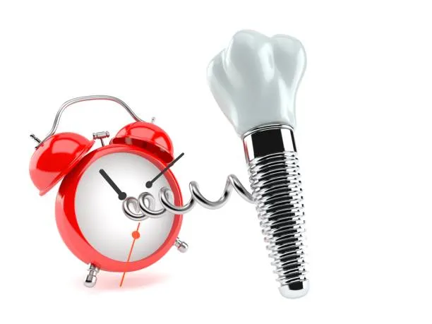 cat dureaza un implant dentar